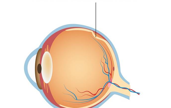 Retinal Detachments & Holes